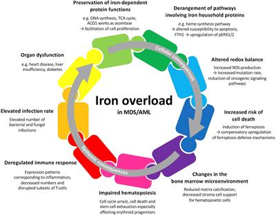 The Clinical Significance of Iron Overload and Iron Metabolism in Myelodysplastic Syndrome and Acute Myeloid Leukemia